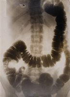 Lot 332 - X-Ray Photographs.