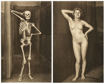 Lot 57 - Hasselwander (Albert). Ein Anatomischer Totentanz... , Munich: Bergmann, 1926
