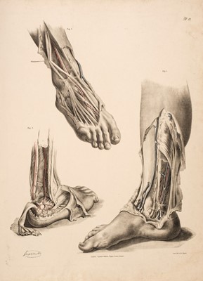 Lot 129 - Maclise (Joseph). Fifty medical and surgical lithographs, circa 1856