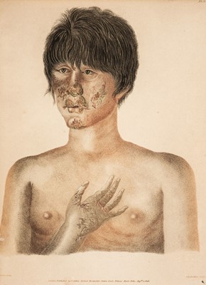 Lot 187 - Adams (Joseph). Observations on Morbid Poisons, Chronic and Acute… , 2nd edition, J. Callow, 1807