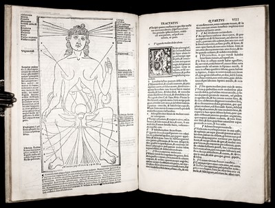 Lot 234 - Ketham (Johannes de). Fasciculus medici[n]e …, Venice: Cesare Arrivabene, March 1522