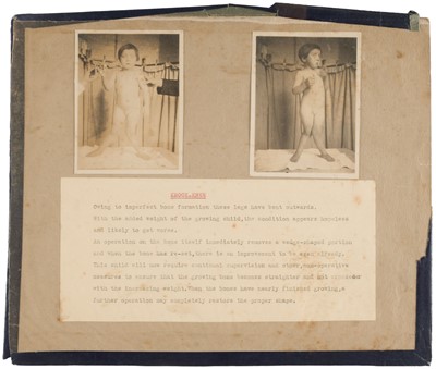 Lot 319 - Orthopaedics. A small archive of ephemera relating to Bernard Whitchurch Howell, c. 1916-1960