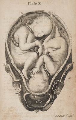 Lot 297 - Smellie (William). A Set of Anatomical Tables, with Explanations,..., 1780..., and others